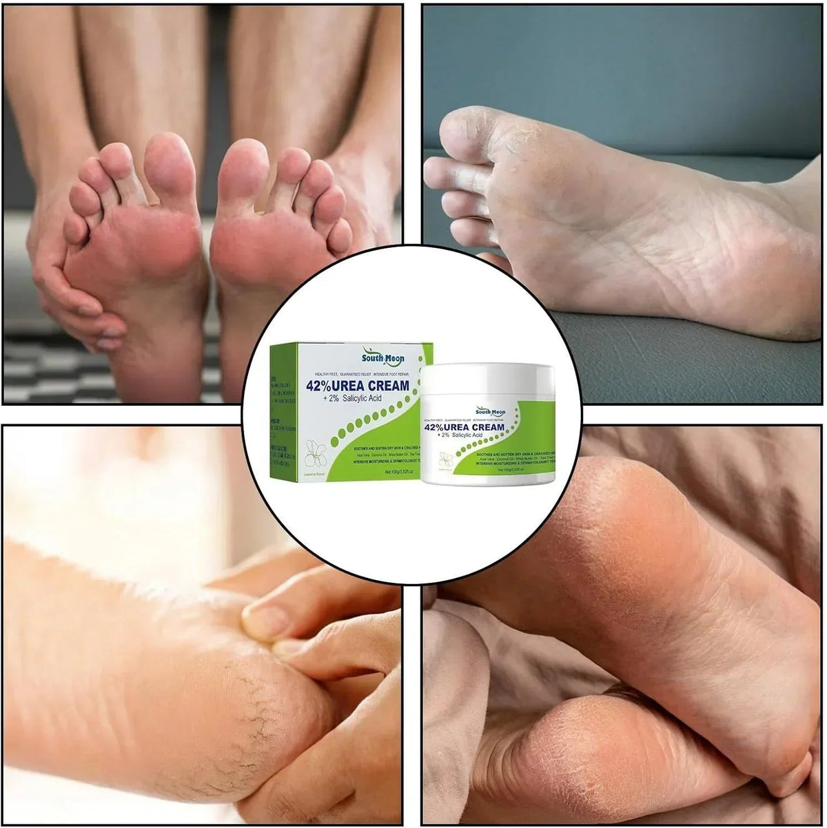 South Moon - 42% Urea Cream + 2% Salicylic Acid (Original) - The Emirates